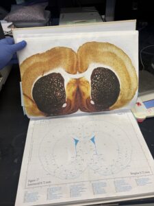 Brain atlas